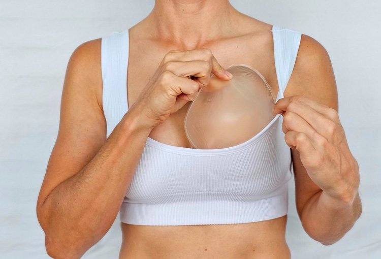 Retiro de implantes mamarios