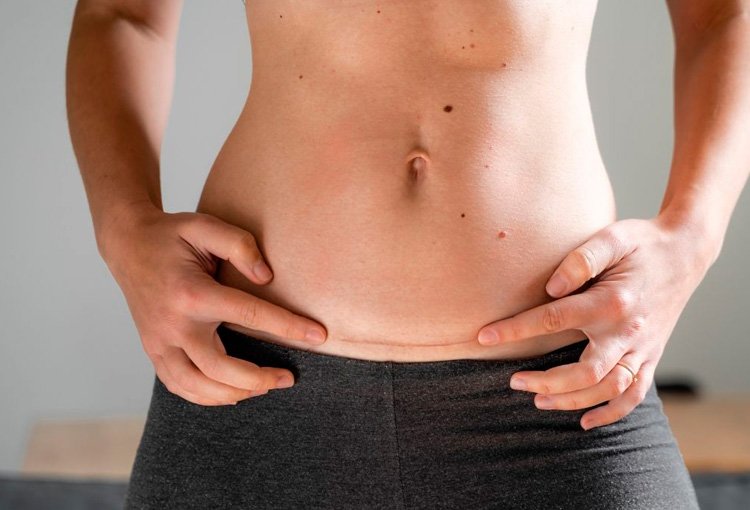 Corrección de cicatrices