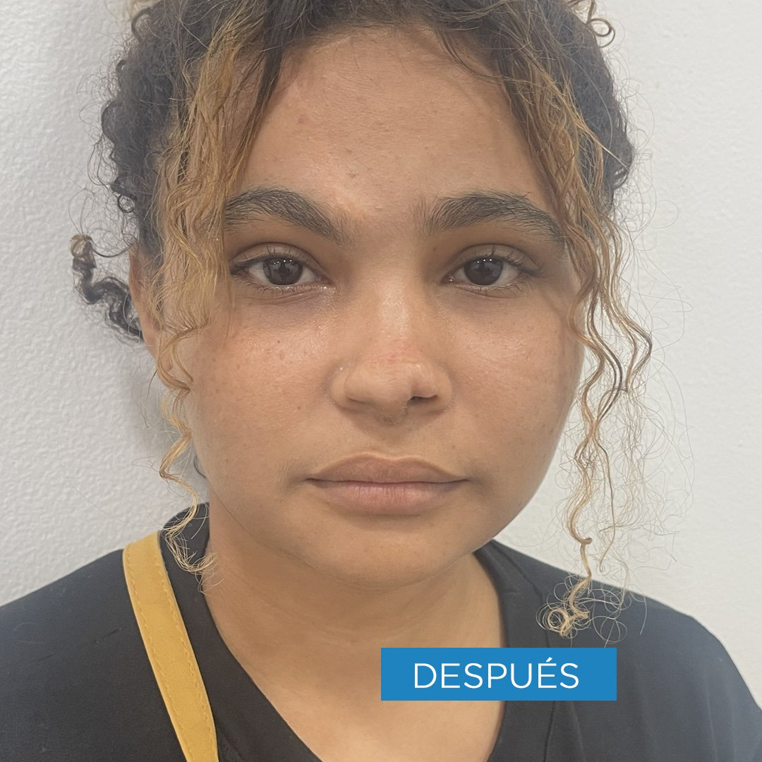 Fotos de Cirugía Reconstructiva después